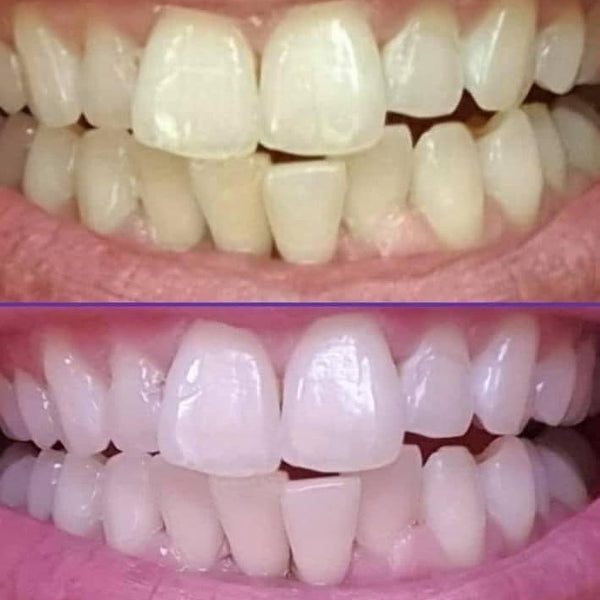 urban retreat diamond lustre tooth cream results